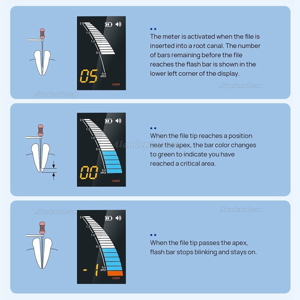 Dental Apex Locator Root Canal Measurement Device Endodontic Finder Micropex Pro